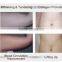 2015 hot sell 4D Multipolar RFCavitation with Fractional RF for weight lose body slim machine
