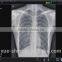 Use for X-ray Machine Detector Digital x-ray flat panel detector