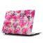 2016 new products oil paiting pretction coase for MacBook size