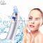 electric nose facial cleanser kit pore cleaner blackhead remover