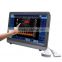 hot sale medical scanner color doppler ultrasound with touch screen