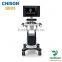 Chison hot selling portable 4d color doppler ultrasound Chison qbit 5
