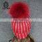 2017 Cheap Beanie Hats Handmade Pompoms Cap Custom Made Knitting Hat
