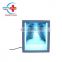 1148 Medical wall mounting single/Doube/Triple X-ray Film Viewer, X-ray film illuminator/ negatoscope