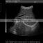 Sonostar 3D Built-in Battery Portable Vascular Cheapest Ultrasound Machine
