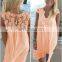 Europe And America Lace Split Joint Chiffon Loose One-Piece Dress