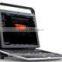 pc based ultrasound scanner portable ultrasound scanner usb ultrasound scanner