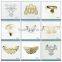 Wholesales gold TPU shoes chain accessories