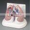 Factory directly supplied human lung cancer biology model