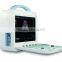 Laptop 3D/4D color doppler ultrasound & portable color doppler ultrasound scanner