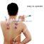 Traditional Chinese Acupunture Vacuum Cupping Therapy Cupping with CE certificate