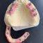 Implant Zirconia Crown and Bridge - China Dental Lab of Good Quality and Professional Technicians