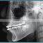 Digital Radiography System Panoramic Machine