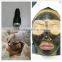 Carbon laser peel facial rejuvenation acne treatment