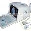 MCSS-6Portable Ultrasound Scanner