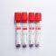 plain blood tube red top blood tube blood test tube