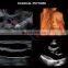Latest Version Sonoscape P15 Trolley Color Ultrasound machine /cw color doppler ultrasound Sonoscape P15
