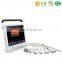 MY-A023B High quality and good price for working on mobile phone/ipad linear wireless probe ultrasound