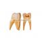 HC-S401 Best Quality Tooth enlargement model/Human Enlarge Dental teeth model
