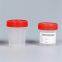 Good Price Medical Plastic Products Disposable Urine Specimen Container Urine Cup