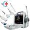 HC-A013 Portable Laptop color doppler ultrasound scanner machine price