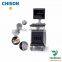 Chison 4d Trolley Color Doppler Ultrasound Machine Chison i8
