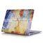 Laptop Hard Case Cover for Macbook 12 Case, Jeans patters