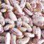 2015 GOOD light speckel kidney beansCHINA (HOT SALE)