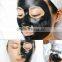 Top Quality Clinic Beauty Machine 532nm 1064nm Black Doll Treatment