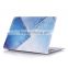 For MacBook 15 inch Case, Hard Case Print Frosted for MacBook Pro 15" ( Jeans pattern ) )