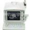 high quality ultrasound scanner for hot sale