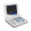 List 3.5MHZ convex array probe 10.4 inch LCD Laptop Portable B ultrasound scanner