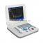 ISO CE approved 10.4 inch SVGA mode HR LCD Laptop Portable pregnancy scanner ultrasound