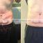 Shockwave Therapy Acoustic Waves HIFU Cellulite Reduction Weight Loss,body Shaping Fat remove Beauty Equipment