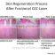 Skin Resurfacing Acne Scar Removal Treatment CO2 Multifunctional Fractional Laser Machine POP IPL FC10