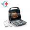 mindray dp10 mindray ultrasound scanner price with 12 inch LED screen