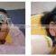 non invasive multifunctional hair removal acne removal laser medical equipment