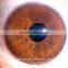 Protable iris analyzer iridology, iris analyzer eye iridology