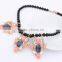Fashion Acrylic Choker Vintage Pendant Statement Necklace Women Necklaces & Pendants Fashion Necklaces for Women 2014