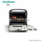 S6 SonoScape medical 3d echo machine color doppler