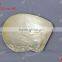 Silver shell / MOP plate