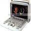 Most Affordable 3D Doppler Ultrasoun