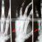 HOT selling thermal dry medical x-ray film /medical x-ray film agfa with CE hot film asia blue