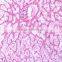 Individual slides you can choose from Educational human tissue pathology of Cancer lymph node metastasis prepared slides