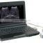 portable PC Notebook digital diagnostic ultrasound scanner WT-6000B