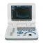 Portable Laptop ultrasound scanner with CE