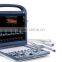 Sonoscape S2 portable ultrasound machine low cost portable ultrasound machine