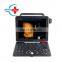 HC-A012F HD Image Portable 4D Color Doppler Ultrasound Equipment Scanner Machine Price /Portable 4D Ultrasound