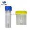 Laboratory 30ml 40ml 60ml Plastic Stool Sample Test Collection Container with Spoon