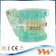 Popular Transparent Plastic Pathologic Dental Implant Model for study